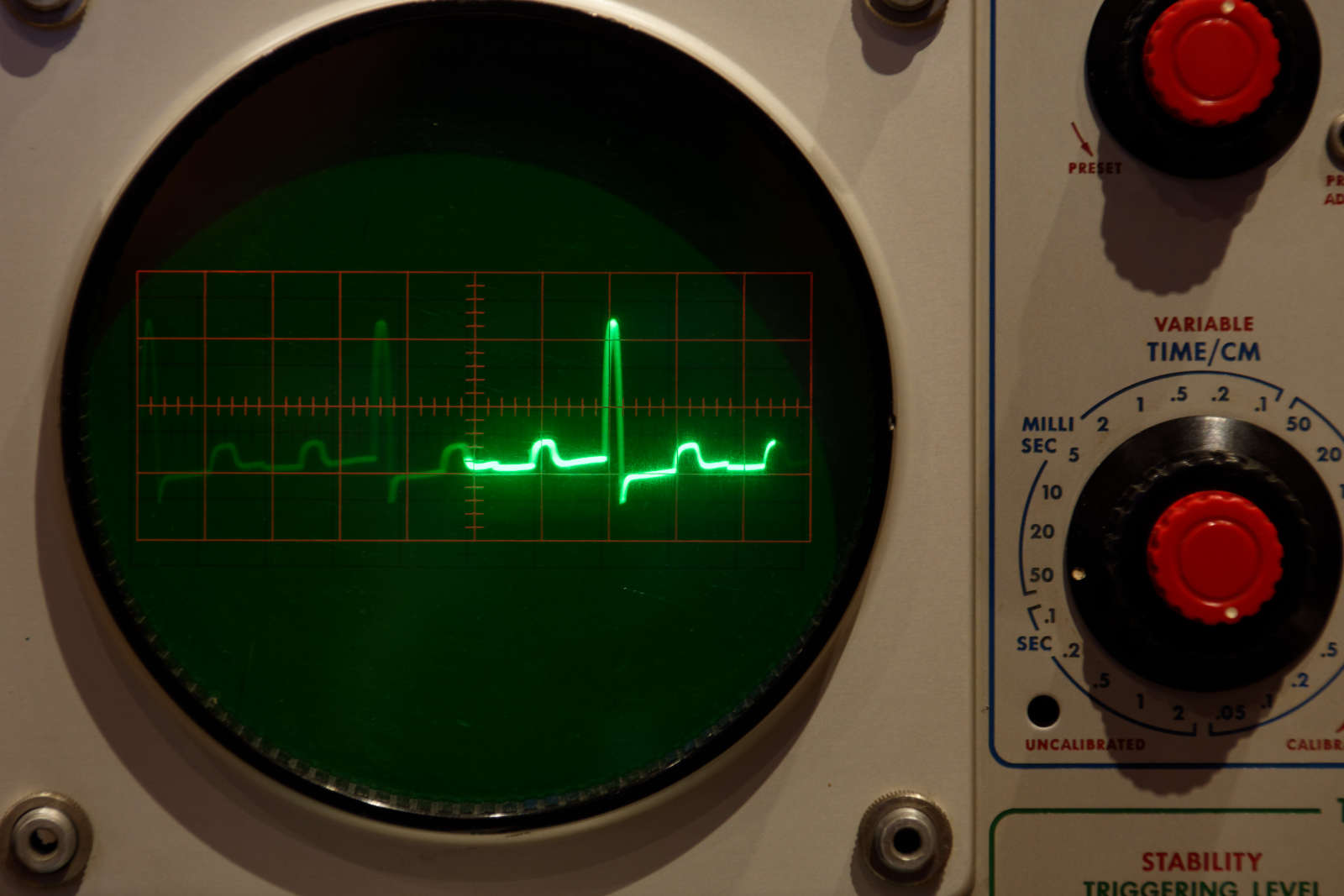 585-ekg-sim.jpg